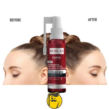 بيوبلاس فورت لمنع تساقط الشعر نتيجة من الشهر الأول Bioblas Forte Anti-Hair Loss Intensive Herbal Serum 60ml 3